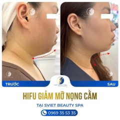 Chị Quỳnh Quỳnh